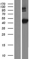 Western blot validation of overexpression lysate (Cat# LY413993) using anti-DDK antibody (Cat# TA50011-100). Left: Cell lysates from un-transfected HEK293T cells; Right: Cell lysates from HEK293T cells transfected with RC222092 using transfection reagent MegaTran 2.0 (Cat# TT210002).