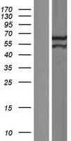 Western blot validation of overexpression lysate (Cat# LY409975) using anti-DDK antibody (Cat# TA50011-100). Left: Cell lysates from un-transfected HEK293T cells; Right: Cell lysates from HEK293T cells transfected with RC202983 using transfection reagent MegaTran 2.0 (Cat# TT210002).