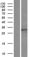 Western blot validation of overexpression lysate (Cat# LY421835) using anti-DDK antibody (Cat# TA50011-100). Left: Cell lysates from un-transfected HEK293T cells; Right: Cell lysates from HEK293T cells transfected with RC210478 using transfection reagent MegaTran 2.0 (Cat# TT210002).