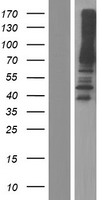 Western blot validation of overexpression lysate (Cat# LY416873) using anti-DDK antibody (Cat# TA50011-100). Left: Cell lysates from un-transfected HEK293T cells; Right: Cell lysates from HEK293T cells transfected with RC201246 using transfection reagent MegaTran 2.0 (Cat# TT210002).