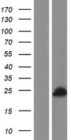 Western blot validation of overexpression lysate (Cat# LY420106) using anti-DDK antibody (Cat# TA50011-100). Left: Cell lysates from un-transfected HEK293T cells; Right: Cell lysates from HEK293T cells transfected with RC212029 using transfection reagent MegaTran 2.0 (Cat# TT210002).