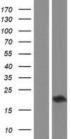 Western blot validation of overexpression lysate (Cat# LY423355) using anti-DDK antibody (Cat# TA50011-100). Left: Cell lysates from un-transfected HEK293T cells; Right: Cell lysates from HEK293T cells transfected with RC205083 using transfection reagent MegaTran 2.0 (Cat# TT210002).