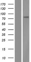 Western blot validation of overexpression lysate (Cat# LY410955) using anti-DDK antibody (Cat# TA50011-100). Left: Cell lysates from un-transfected HEK293T cells; Right: Cell lysates from HEK293T cells transfected with RC203653 using transfection reagent MegaTran 2.0 (Cat# TT210002).