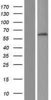 Western blot validation of overexpression lysate (Cat# LY415941) using anti-DDK antibody (Cat# TA50011-100). Left: Cell lysates from un-transfected HEK293T cells; Right: Cell lysates from HEK293T cells transfected with RC207676 using transfection reagent MegaTran 2.0 (Cat# TT210002).