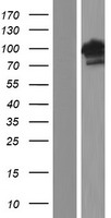 Western blot validation of overexpression lysate (Cat# LY420708) using anti-DDK antibody (Cat# TA50011-100). Left: Cell lysates from un-transfected HEK293T cells; Right: Cell lysates from HEK293T cells transfected with RC215913 using transfection reagent MegaTran 2.0 (Cat# TT210002).