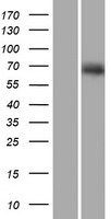 Western blot validation of overexpression lysate (Cat# LY406676) using anti-DDK antibody (Cat# TA50011-100). Left: Cell lysates from un-transfected HEK293T cells; Right: Cell lysates from HEK293T cells transfected with RC206153 using transfection reagent MegaTran 2.0 (Cat# TT210002).