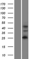 Western blot validation of overexpression lysate (Cat# LY408853) using anti-DDK antibody (Cat# TA50011-100). Left: Cell lysates from un-transfected HEK293T cells; Right: Cell lysates from HEK293T cells transfected with RC208998 using transfection reagent MegaTran 2.0 (Cat# TT210002).