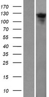 Western blot validation of overexpression lysate (Cat# LY408032) using anti-DDK antibody (Cat# TA50011-100). Left: Cell lysates from un-transfected HEK293T cells; Right: Cell lysates from HEK293T cells transfected with RC206107 using transfection reagent MegaTran 2.0 (Cat# TT210002).