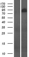 Western blot validation of overexpression lysate (Cat# LY410232) using anti-DDK antibody (Cat# TA50011-100). Left: Cell lysates from un-transfected HEK293T cells; Right: Cell lysates from HEK293T cells transfected with RC207720 using transfection reagent MegaTran 2.0 (Cat# TT210002).