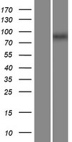 Western blot validation of overexpression lysate (Cat# LY416161) using anti-DDK antibody (Cat# TA50011-100). Left: Cell lysates from un-transfected HEK293T cells; Right: Cell lysates from HEK293T cells transfected with RC209165 using transfection reagent MegaTran 2.0 (Cat# TT210002).
