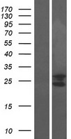 Western blot validation of overexpression lysate (Cat# LY424109) using anti-DDK antibody (Cat# TA50011-100). Left: Cell lysates from un-transfected HEK293T cells; Right: Cell lysates from HEK293T cells transfected with RC208289 using transfection reagent MegaTran 2.0 (Cat# TT210002).