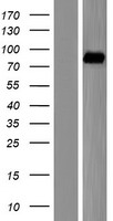 Western blot validation of overexpression lysate (Cat# LY407048) using anti-DDK antibody (Cat# TA50011-100). Left: Cell lysates from un-transfected HEK293T cells; Right: Cell lysates from HEK293T cells transfected with RC202372 using transfection reagent MegaTran 2.0 (Cat# TT210002).