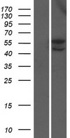 Western blot validation of overexpression lysate (Cat# LY405638) using anti-DDK antibody (Cat# TA50011-100). Left: Cell lysates from un-transfected HEK293T cells; Right: Cell lysates from HEK293T cells transfected with RC208462 using transfection reagent MegaTran 2.0 (Cat# TT210002).