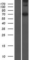 Western blot validation of overexpression lysate (Cat# LY406484) using anti-DDK antibody (Cat# TA50011-100). Left: Cell lysates from un-transfected HEK293T cells; Right: Cell lysates from HEK293T cells transfected with RC206712 using transfection reagent MegaTran 2.0 (Cat# TT210002).