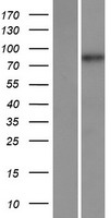 Western blot validation of overexpression lysate (Cat# LY417276) using anti-DDK antibody (Cat# TA50011-100). Left: Cell lysates from un-transfected HEK293T cells; Right: Cell lysates from HEK293T cells transfected with RC219597 using transfection reagent MegaTran 2.0 (Cat# TT210002).