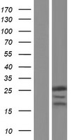 Western blot validation of overexpression lysate (Cat# LY413534) using anti-DDK antibody (Cat# TA50011-100). Left: Cell lysates from un-transfected HEK293T cells; Right: Cell lysates from HEK293T cells transfected with RC203538 using transfection reagent MegaTran 2.0 (Cat# TT210002).