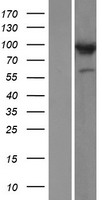 Western blot validation of overexpression lysate (Cat# LY410509) using anti-DDK antibody (Cat# TA50011-100). Left: Cell lysates from un-transfected HEK293T cells; Right: Cell lysates from HEK293T cells transfected with RC211749 using transfection reagent MegaTran 2.0 (Cat# TT210002).