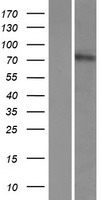 Western blot validation of overexpression lysate (Cat# LY410909) using anti-DDK antibody (Cat# TA50011-100). Left: Cell lysates from un-transfected HEK293T cells; Right: Cell lysates from HEK293T cells transfected with RC224386 using transfection reagent MegaTran 2.0 (Cat# TT210002).