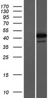 Western blot validation of overexpression lysate (Cat# LY413844) using anti-DDK antibody (Cat# TA50011-100). Left: Cell lysates from un-transfected HEK293T cells; Right: Cell lysates from HEK293T cells transfected with RC204108 using transfection reagent MegaTran 2.0 (Cat# TT210002).