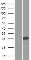 Western blot validation of overexpression lysate (Cat# LY416490) using anti-DDK antibody (Cat# TA50011-100). Left: Cell lysates from un-transfected HEK293T cells; Right: Cell lysates from HEK293T cells transfected with RC201176 using transfection reagent MegaTran 2.0 (Cat# TT210002).