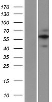 Western blot validation of overexpression lysate (Cat# LY413707) using anti-DDK antibody (Cat# TA50011-100). Left: Cell lysates from un-transfected HEK293T cells; Right: Cell lysates from HEK293T cells transfected with RC215864 using transfection reagent MegaTran 2.0 (Cat# TT210002).