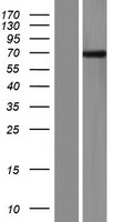 Western blot validation of overexpression lysate (Cat# LY404384) using anti-DDK antibody (Cat# TA50011-100). Left: Cell lysates from un-transfected HEK293T cells; Right: Cell lysates from HEK293T cells transfected with RC208823 using transfection reagent MegaTran 2.0 (Cat# TT210002).