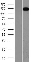 Western blot validation of overexpression lysate (Cat# LY414796) using anti-DDK antibody (Cat# TA50011-100). Left: Cell lysates from un-transfected HEK293T cells; Right: Cell lysates from HEK293T cells transfected with RC207147 using transfection reagent MegaTran 2.0 (Cat# TT210002).