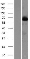 Western blot validation of overexpression lysate (Cat# LY424245) using anti-DDK antibody (Cat# TA50011-100). Left: Cell lysates from un-transfected HEK293T cells; Right: Cell lysates from HEK293T cells transfected with RC206245 using transfection reagent MegaTran 2.0 (Cat# TT210002).
