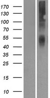 Western blot validation of overexpression lysate (Cat# LY424247) using anti-DDK antibody (Cat# TA50011-100). Left: Cell lysates from un-transfected HEK293T cells; Right: Cell lysates from HEK293T cells transfected with RC214747 using transfection reagent MegaTran 2.0 (Cat# TT210002).