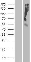 Western blot validation of overexpression lysate (Cat# LY424250) using anti-DDK antibody (Cat# TA50011-100). Left: Cell lysates from un-transfected HEK293T cells; Right: Cell lysates from HEK293T cells transfected with RC224248 using transfection reagent MegaTran 2.0 (Cat# TT210002).