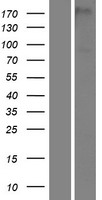 Western blot validation of overexpression lysate (Cat# LY424307) using anti-DDK antibody (Cat# TA50011-100). Left: Cell lysates from un-transfected HEK293T cells; Right: Cell lysates from HEK293T cells transfected with RC224357 using transfection reagent MegaTran 2.0 (Cat# TT210002).