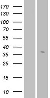 Western blot validation of overexpression lysate (Cat# LY424129) using anti-DDK antibody (Cat# TA50011-100). Left: Cell lysates from un-transfected HEK293T cells; Right: Cell lysates from HEK293T cells transfected with RC213805 using transfection reagent MegaTran 2.0 (Cat# TT210002).