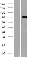 Western blot validation of overexpression lysate (Cat# LY423999) using anti-DDK antibody (Cat# TA50011-100). Left: Cell lysates from un-transfected HEK293T cells; Right: Cell lysates from HEK293T cells transfected with RC223105 using transfection reagent MegaTran 2.0 (Cat# TT210002).