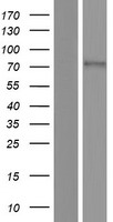 Western blot validation of overexpression lysate (Cat# LY424027) using anti-DDK antibody (Cat# TA50011-100). Left: Cell lysates from un-transfected HEK293T cells; Right: Cell lysates from HEK293T cells transfected with RC212948 using transfection reagent MegaTran 2.0 (Cat# TT210002).