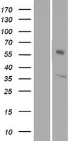 Western blot validation of overexpression lysate (Cat# LY423758) using anti-DDK antibody (Cat# TA50011-100). Left: Cell lysates from un-transfected HEK293T cells; Right: Cell lysates from HEK293T cells transfected with RC211356 using transfection reagent MegaTran 2.0 (Cat# TT210002).