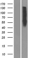 Western blot validation of overexpression lysate (Cat# LY423781) using anti-DDK antibody (Cat# TA50011-100). Left: Cell lysates from un-transfected HEK293T cells; Right: Cell lysates from HEK293T cells transfected with RC217906 using transfection reagent MegaTran 2.0 (Cat# TT210002).
