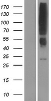 Western blot validation of overexpression lysate (Cat# LY423880) using anti-DDK antibody (Cat# TA50011-100). Left: Cell lysates from un-transfected HEK293T cells; Right: Cell lysates from HEK293T cells transfected with RC224455 using transfection reagent MegaTran 2.0 (Cat# TT210002).