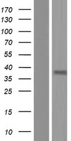 Western blot validation of overexpression lysate (Cat# LY423887) using anti-DDK antibody (Cat# TA50011-100). Left: Cell lysates from un-transfected HEK293T cells; Right: Cell lysates from HEK293T cells transfected with RC218005 using transfection reagent MegaTran 2.0 (Cat# TT210002).