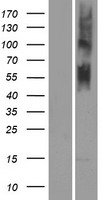 Western blot validation of overexpression lysate (Cat# LY423907) using anti-DDK antibody (Cat# TA50011-100). Left: Cell lysates from un-transfected HEK293T cells; Right: Cell lysates from HEK293T cells transfected with RC212402 using transfection reagent MegaTran 2.0 (Cat# TT210002).