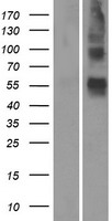Western blot validation of overexpression lysate (Cat# LY423908) using anti-DDK antibody (Cat# TA50011-100). Left: Cell lysates from un-transfected HEK293T cells; Right: Cell lysates from HEK293T cells transfected with RC213195 using transfection reagent MegaTran 2.0 (Cat# TT210002).