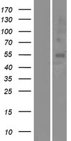 Western blot validation of overexpression lysate (Cat# LY423911) using anti-DDK antibody (Cat# TA50011-100). Left: Cell lysates from un-transfected HEK293T cells; Right: Cell lysates from HEK293T cells transfected with RC215187 using transfection reagent MegaTran 2.0 (Cat# TT210002).