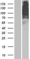 Western blot validation of overexpression lysate (Cat# LY423913) using anti-DDK antibody (Cat# TA50011-100). Left: Cell lysates from un-transfected HEK293T cells; Right: Cell lysates from HEK293T cells transfected with RC222978 using transfection reagent MegaTran 2.0 (Cat# TT210002).