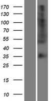 Western blot validation of overexpression lysate (Cat# LY423967) using anti-DDK antibody (Cat# TA50011-100). Left: Cell lysates from un-transfected HEK293T cells; Right: Cell lysates from HEK293T cells transfected with RC222298 using transfection reagent MegaTran 2.0 (Cat# TT210002).