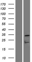 Western blot validation of overexpression lysate (Cat# LY423977) using anti-DDK antibody (Cat# TA50011-100). Left: Cell lysates from un-transfected HEK293T cells; Right: Cell lysates from HEK293T cells transfected with RC220262 using transfection reagent MegaTran 2.0 (Cat# TT210002).