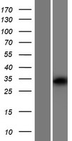 Western blot validation of overexpression lysate (Cat# LY423852) using anti-DDK antibody (Cat# TA50011-100). Left: Cell lysates from un-transfected HEK293T cells; Right: Cell lysates from HEK293T cells transfected with RC222467 using transfection reagent MegaTran 2.0 (Cat# TT210002).