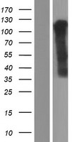 Western blot validation of overexpression lysate (Cat# LY423855) using anti-DDK antibody (Cat# TA50011-100). Left: Cell lysates from un-transfected HEK293T cells; Right: Cell lysates from HEK293T cells transfected with RC220418 using transfection reagent MegaTran 2.0 (Cat# TT210002).