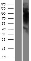 Western blot validation of overexpression lysate (Cat# LY423620) using anti-DDK antibody (Cat# TA50011-100). Left: Cell lysates from un-transfected HEK293T cells; Right: Cell lysates from HEK293T cells transfected with RC223956 using transfection reagent MegaTran 2.0 (Cat# TT210002).