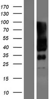 Western blot validation of overexpression lysate (Cat# LY423218) using anti-DDK antibody (Cat# TA50011-100). Left: Cell lysates from un-transfected HEK293T cells; Right: Cell lysates from HEK293T cells transfected with RC224118 using transfection reagent MegaTran 2.0 (Cat# TT210002).