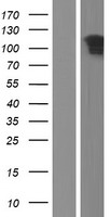 Western blot validation of overexpression lysate (Cat# LY423318) using anti-DDK antibody (Cat# TA50011-100). Left: Cell lysates from un-transfected HEK293T cells; Right: Cell lysates from HEK293T cells transfected with RC219352 using transfection reagent MegaTran 2.0 (Cat# TT210002).