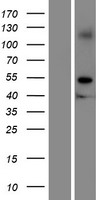 Western blot validation of overexpression lysate (Cat# LY422890) using anti-DDK antibody (Cat# TA50011-100). Left: Cell lysates from un-transfected HEK293T cells; Right: Cell lysates from HEK293T cells transfected with RC220145 using transfection reagent MegaTran 2.0 (Cat# TT210002).